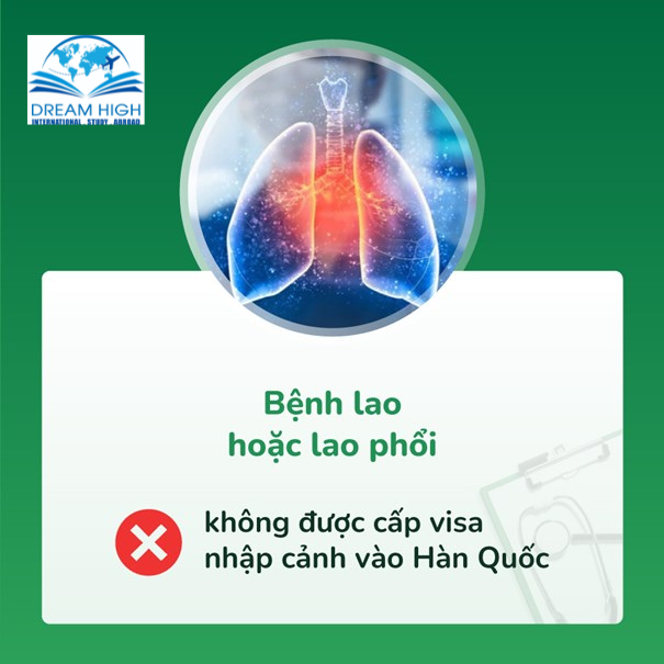 Bệnh lao phổi khi đi khám sức khỏe